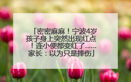 密密麻麻！宁波4岁孩子身上突然出现红点！连小便都变红了……家长：以为只是摔伤